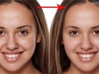 给有青春痘的美女脸部皮肤柔化处理 PS人像后期皮肤美化处理