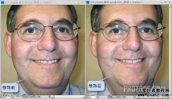 用photoshop给偏色多斑的中老年人脸部祛斑美容教程实例