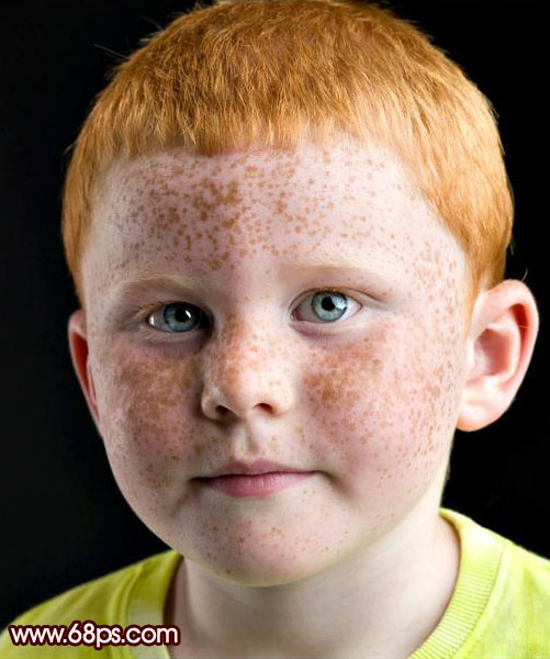 Photoshop 小男孩满脸的斑点消除