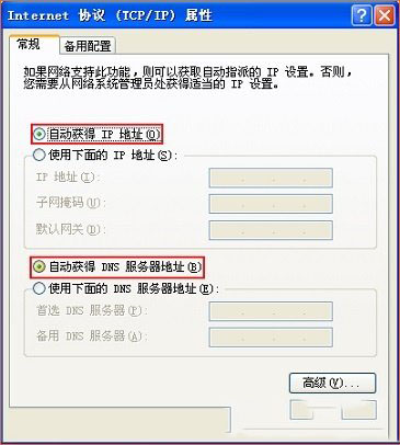 把IP地址设置为自动获得