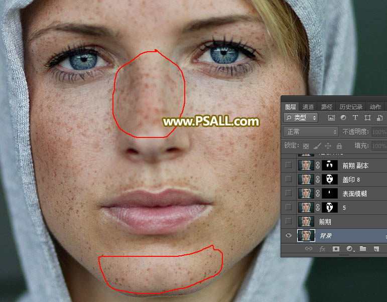对满脸雀斑人像照片后期磨皮的PS教程