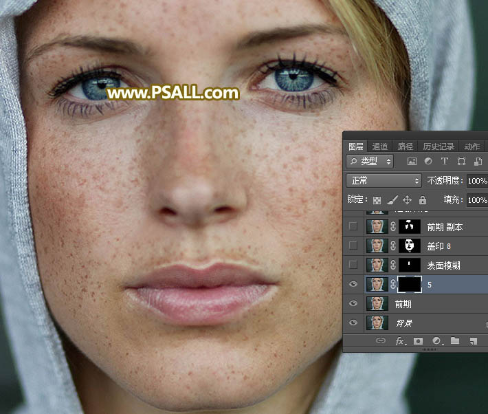对满脸雀斑人像照片后期磨皮的PS教程