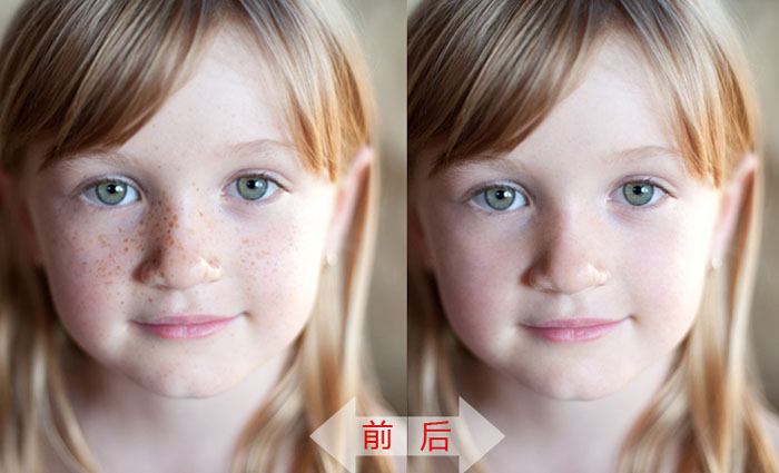 怎么修补女孩照片脸上斑点的PS技巧