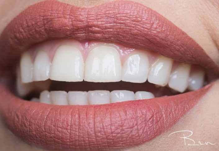 美白牙齿，分享四种美白牙齿的方法